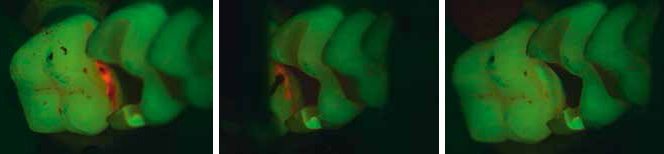 Zeiss Extaro 300 Fluorescence Mode